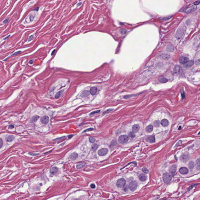 MRP patch2