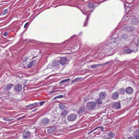 MRP patch1