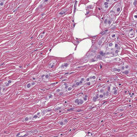 MRP patch4